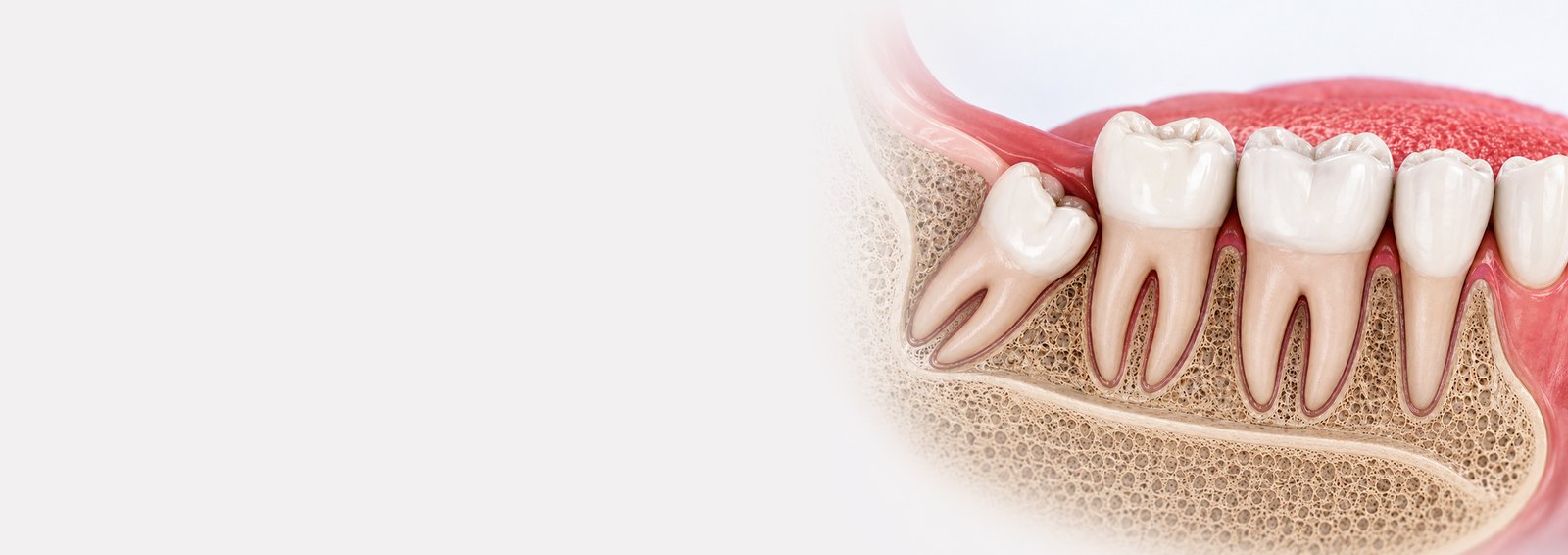 Wisdom Teeth Removal in nellore